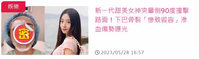 香港新一代女神受傷毀容!逛街突然暈倒臉撞地,急花9萬做手術