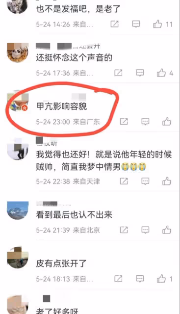 李連杰:身體狀況令人擔憂,低調到內地代言遊戲,長相發生大變化