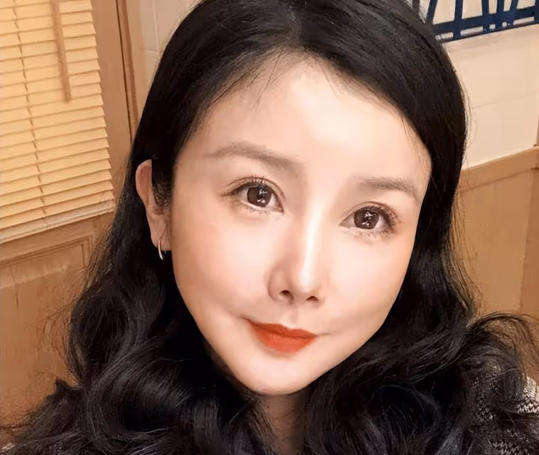 臉像鞋拔子,下巴能犁地?中老年女明星整容後遺症有多可怕?