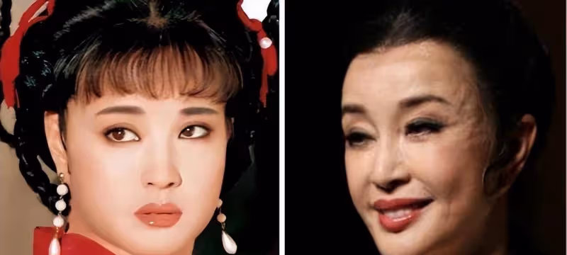 臉像鞋拔子,下巴能犁地?中老年女明星整容後遺症有多可怕?