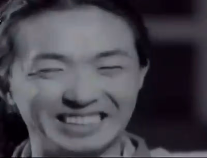 最後一天當男人的金星,在醫院接受採訪,變身手術為什麼不打麻藥