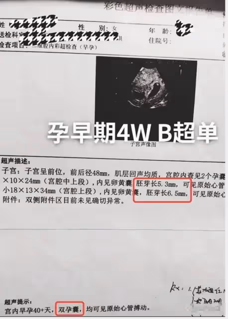 陳萌官宣產下雙胞胎,孩子樣貌不像朱小偉,網友建議做親子鑑定