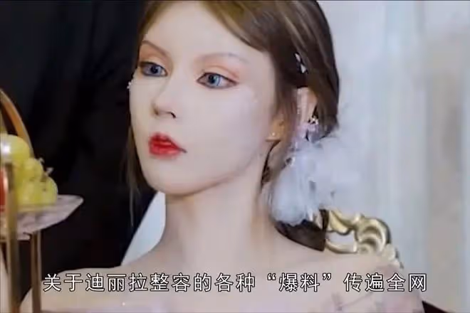 臉上動刀108次，不敢張嘴吃飯，堅稱沒有整容，這個女孩還有救嗎
