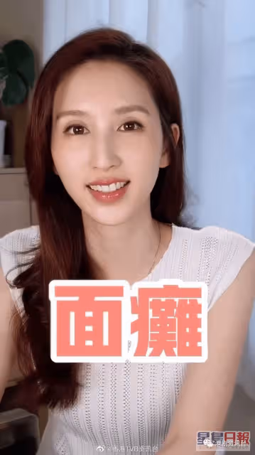 前TVB小花消失原來是這個原因!曾是絕美臉蛋卻患上面癱