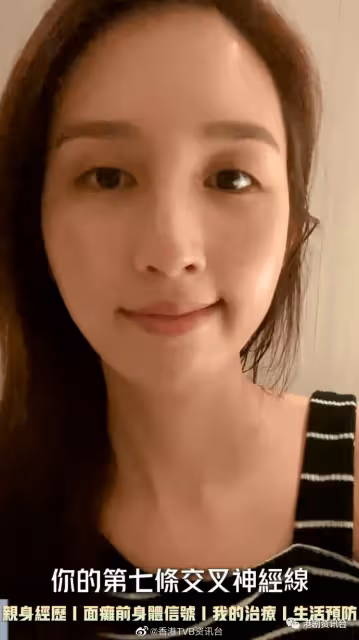 前TVB小花消失原來是這個原因!曾是絕美臉蛋卻患上面癱