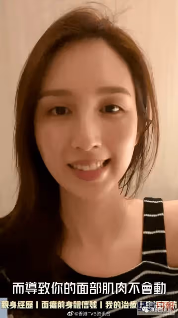 前TVB小花消失原來是這個原因!曾是絕美臉蛋卻患上面癱
