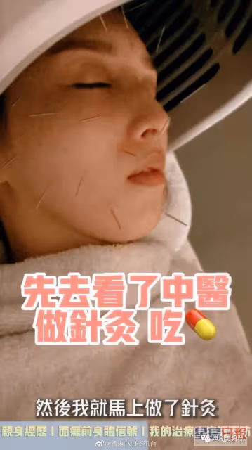前TVB小花消失原來是這個原因!曾是絕美臉蛋卻患上面癱