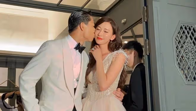 林志玲出席活動認不出,臉部繃緊蘋果肌凸出,五官變化大塑膠感強