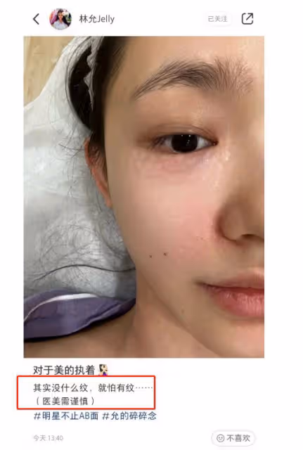 27歲林允公開醫美過程,為去皺紋臉上扎滿針眼,直呼醫美需謹慎