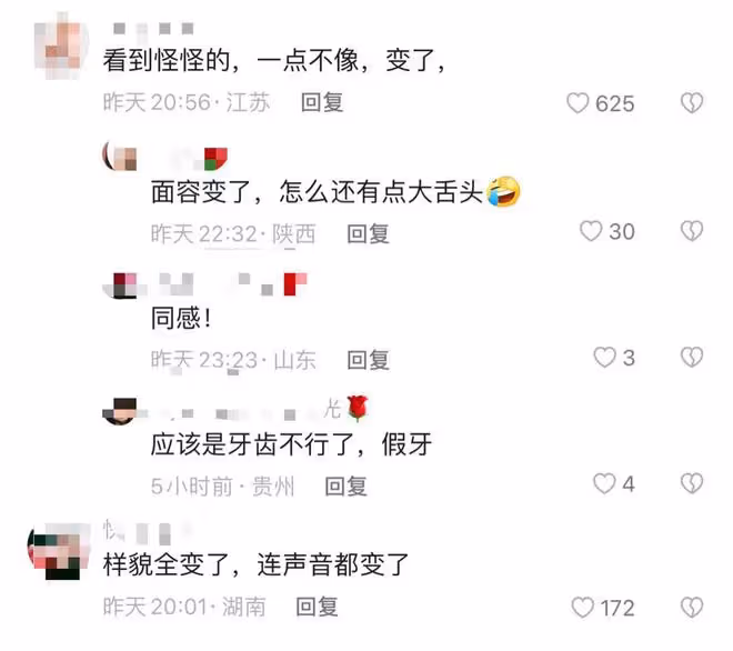 倪萍將演劉姥姥被指瘦脫相!下巴尖鼻孔外翻大變樣,說話疑大舌頭