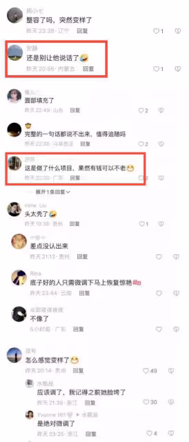 44歲章子怡無濾鏡照曝光,網友指其整容變樣認不出來,成了鷹鉤鼻