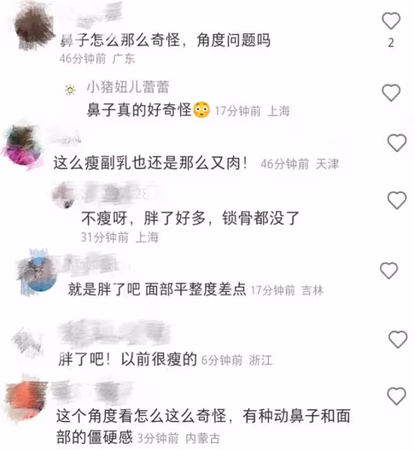 袁姍姍近照大變樣,手臂變粗胖到沒鎖骨,還被質疑臉僵動鼻子