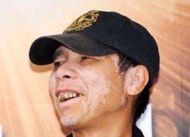 65歲馮小剛白癜風好了!皮膚光滑胖了不少,疑似去美國尋醫問藥
