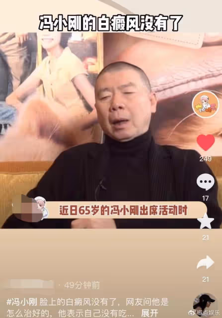 65歲馮小剛白癜風痊癒？自稱沒用任何藥，但頭皮離奇禿了一大片