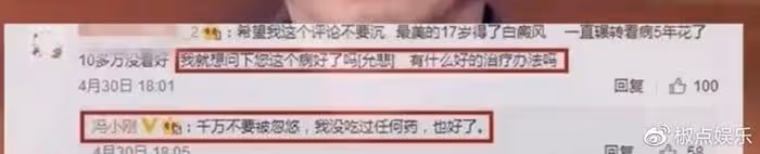 65歲馮小剛白癜風痊癒？自稱沒用任何藥，但頭皮離奇禿了一大片
