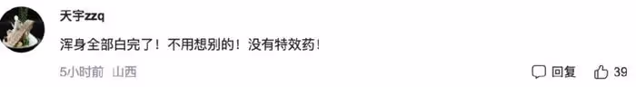 65歲馮小剛白癜風痊癒？自稱沒用任何藥，但頭皮離奇禿了一大片