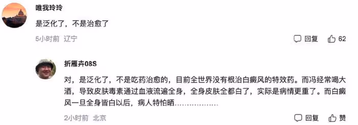 65歲馮小剛白癜風痊癒?自稱沒用任何藥,但頭皮離奇禿了一大片