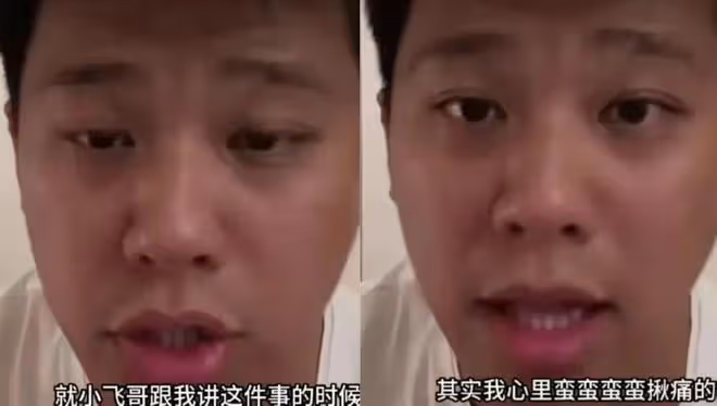 汪小菲暴瘦引擔憂!眼睛紅腫歐式大雙矚目,剛摔骨折又被疑得甲亢