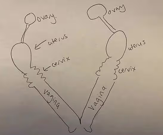 震驚!女子竟然擁有雙倍生殖器,左邊為職業所需,右邊為男友專屬