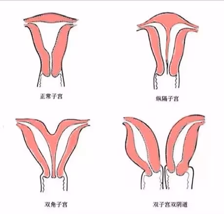 震驚!女子竟然擁有雙倍生殖器,左邊為職業所需,右邊為男友專屬