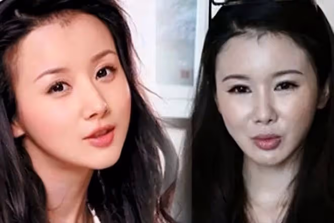 一陣沒見又變了模樣,牛莉臉再崩,面部僵鼻子假難認出,這是咋了