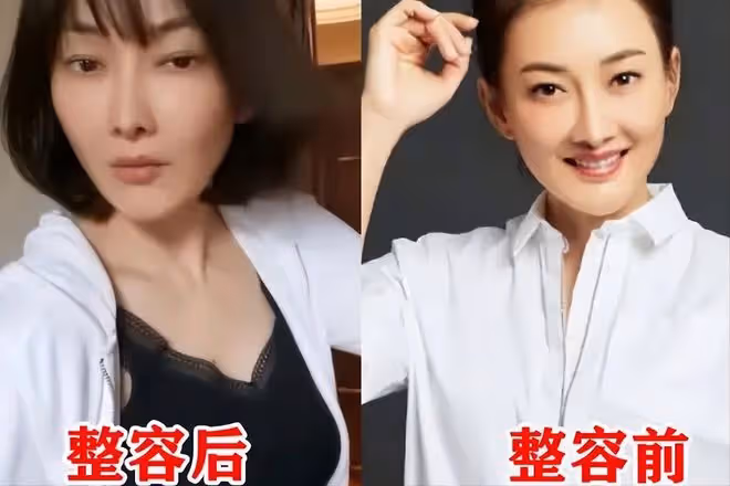 一陣沒見又變了模樣,牛莉臉再崩,面部僵鼻子假難認出,這是咋了