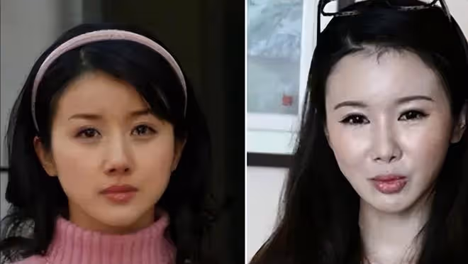 一陣沒見又變了模樣，牛莉臉再崩，面部僵鼻子假難認出，這是咋了