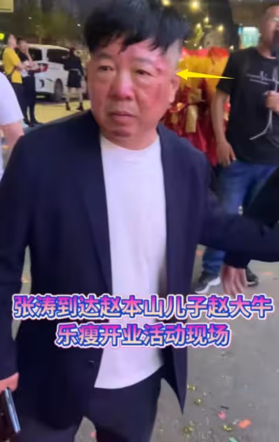趙本山兒子開業：宋小寶謙卑、劉能和美女互動樂開花，張濤疑被打
