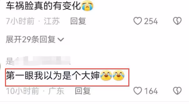 林志穎生圖近照翻車,面部僵硬褶皺明顯,被調侃像大嬸