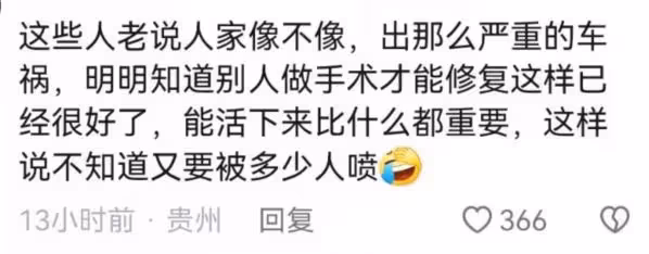 林志穎生圖近照翻車,面部僵硬褶皺明顯,被調侃像大嬸