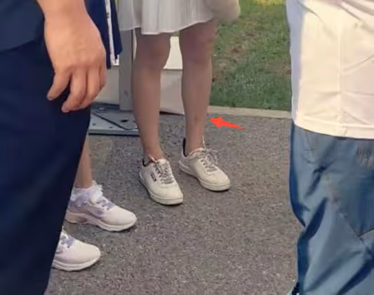 霍思燕帶兒子參加親子跑,穿短裙腿部疤痕明顯,嗯哼牙齒突出搶鏡