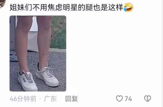 霍思燕帶兒子參加親子跑,穿短裙腿部疤痕明顯,嗯哼牙齒突出搶鏡