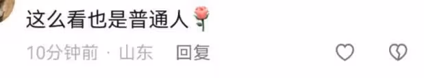 霍思燕帶兒子參加親子跑,穿短裙腿部疤痕明顯,嗯哼牙齒突出搶鏡
