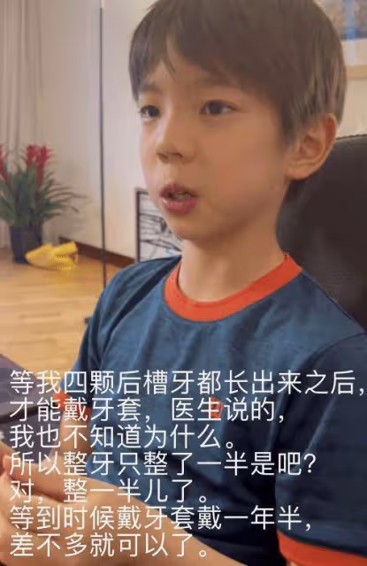 霍思燕帶兒子參加親子跑,穿短裙腿部疤痕明顯,嗯哼牙齒突出搶鏡