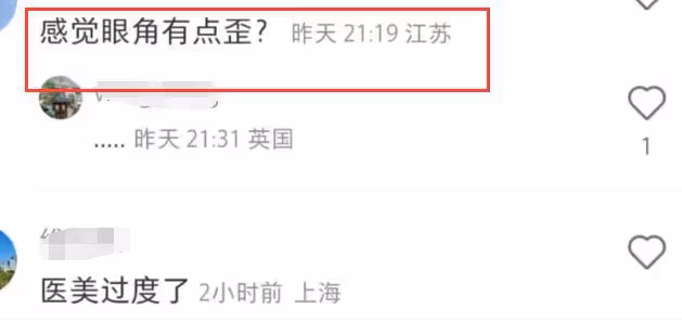迪士尼偶遇毛曉彤,雙馬尾編髮造型似少女,眼角變歪疑似整容