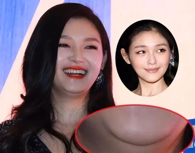 18歲的靈魂81歲的身體?新老公爆料她虛弱到不能走路,大S到底怎麼了?