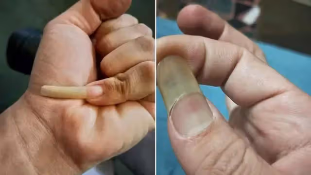 公公指甲超長卻不剪!媳婦崩潰「到底留著要幹嘛?」 專業網友給出解釋「不是為了挖鼻孔」