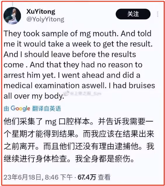 26歲女子在馬代旅遊被侵犯,曬渾身淤青照,卻被網絡色狼點評身材