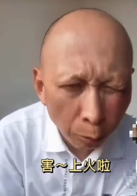 54歲老戲骨李明曬近照,臉頰紅腫明顯緊皺眉,表示要對老婆好點