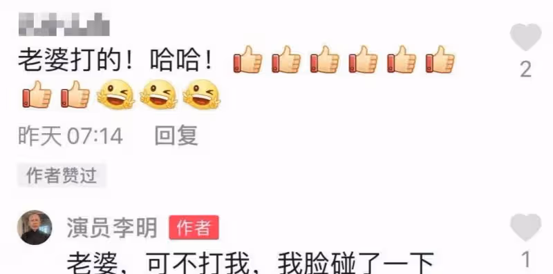 54歲老戲骨李明曬近照,臉頰紅腫明顯緊皺眉,表示要對老婆好點