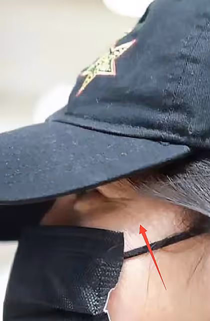 47歲趙薇久違現身，素顏顯老發福不少，眼睛水腫凸出變得好奇怪