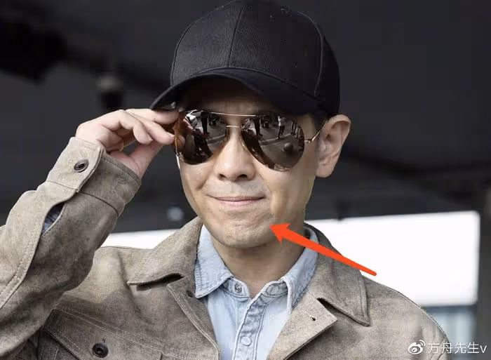 林志穎抵達長沙錄《披荊斬棘》,車禍後下巴凹凸不平被指像俞灝明