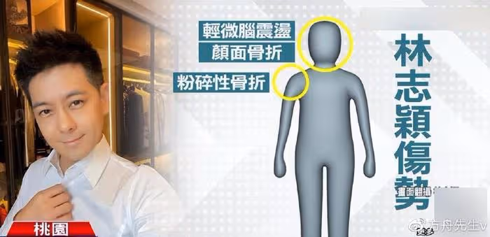 林志穎抵達長沙錄《披荊斬棘》,車禍後下巴凹凸不平被指像俞灝明