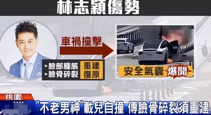 林志穎抵達長沙錄《披荊斬棘》,車禍後下巴凹凸不平被指像俞灝明