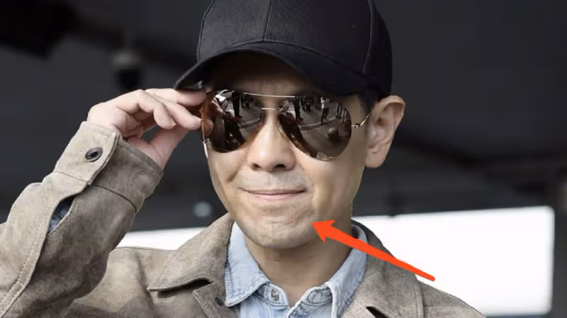 林志穎抵達長沙，車禍不到1年就錄製《披荊斬棘3》，下巴凹凸不平