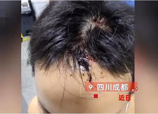 29歲女子遭家暴致殘:被折磨9小時,腸子被打斷,內臟被糞便污染