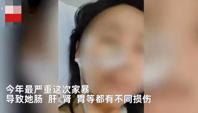 29歲女子遭家暴致殘:被折磨9小時,腸子被打斷,內臟被糞便污染