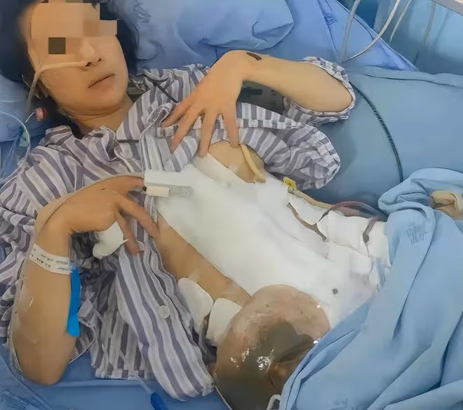 29歲女子遭家暴致殘:被折磨9小時,腸子被打斷,內臟被糞便污染
