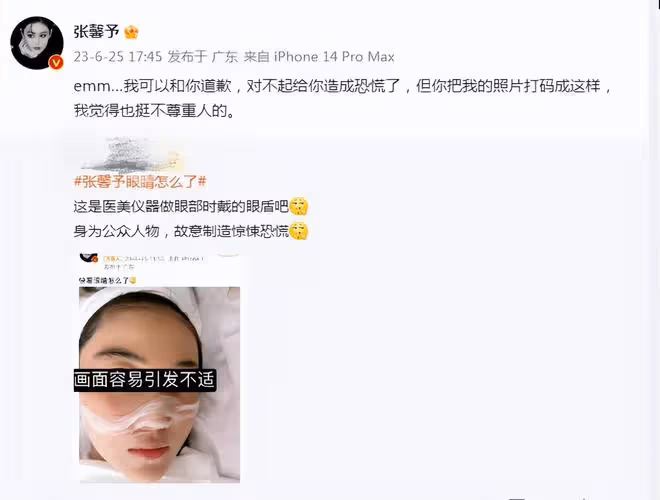 張馨予戴美瞳被嘲製造恐慌,本人發文道歉,斥網友P圖不尊重人