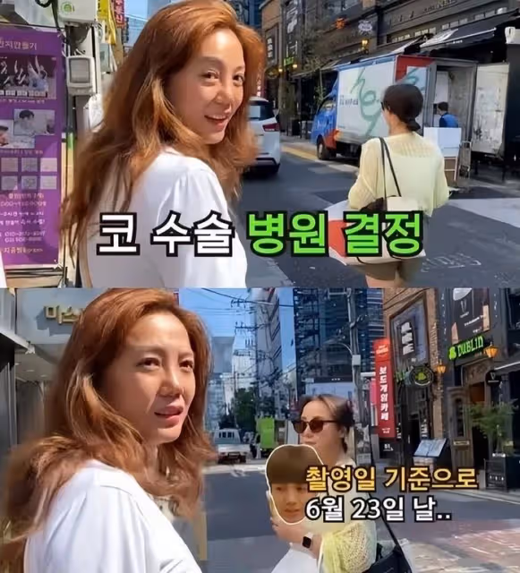 韓國女星承認鼻子手術,費用是一輛中級轎車價格,幾個月不能喝酒